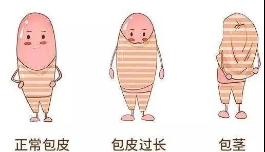 【保山安利醫(yī)院】家長速看！暑期包皮手術(shù)預(yù)約正當時！