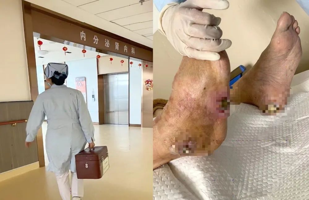 【保山安利醫(yī)院】傷口治療一站式，健康生活零距離！